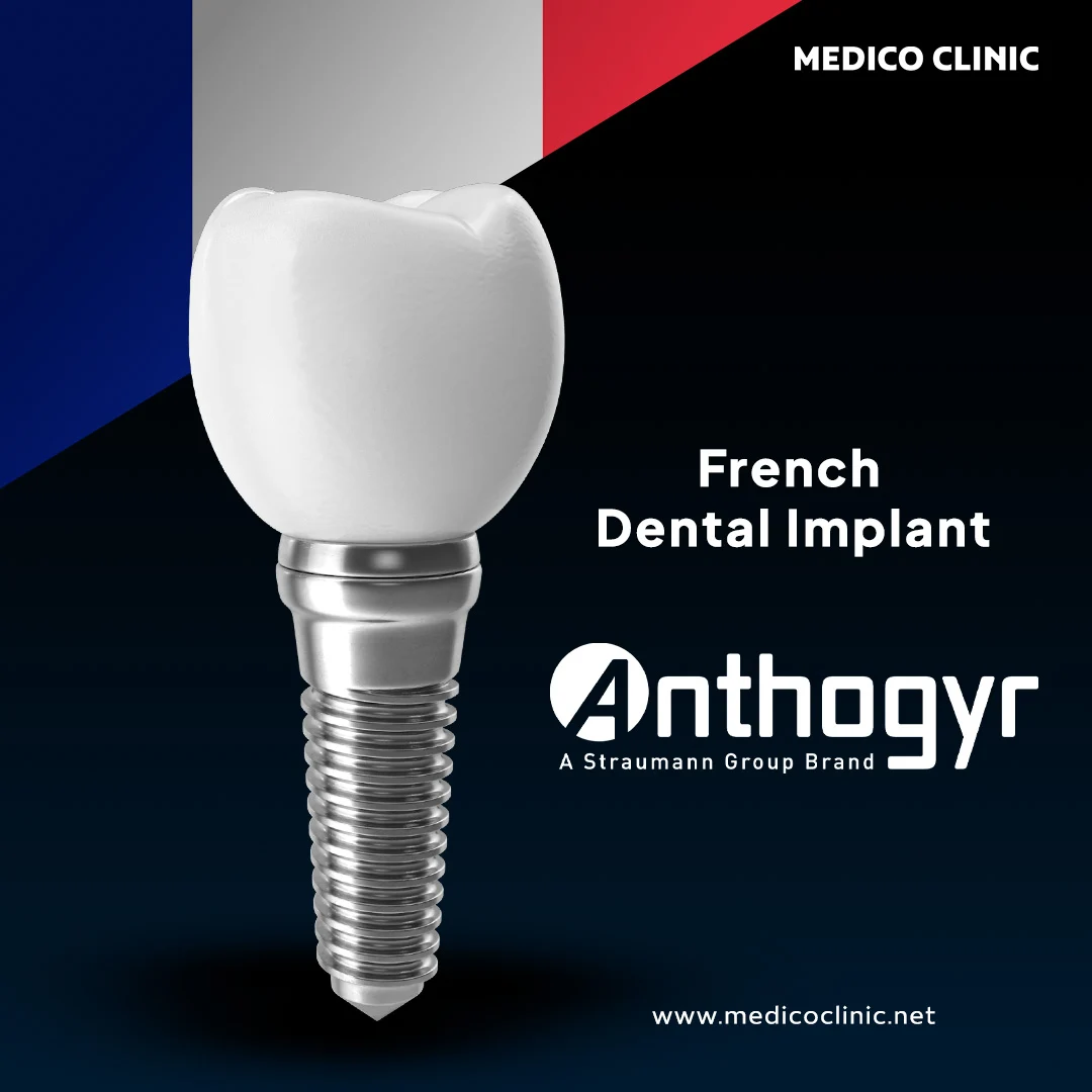 Anthogyr dental implant system