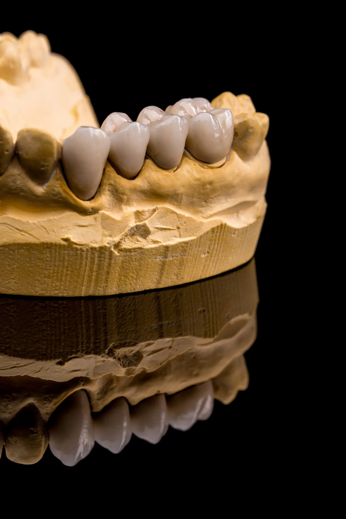 Dental restorations prepared in the laboratory