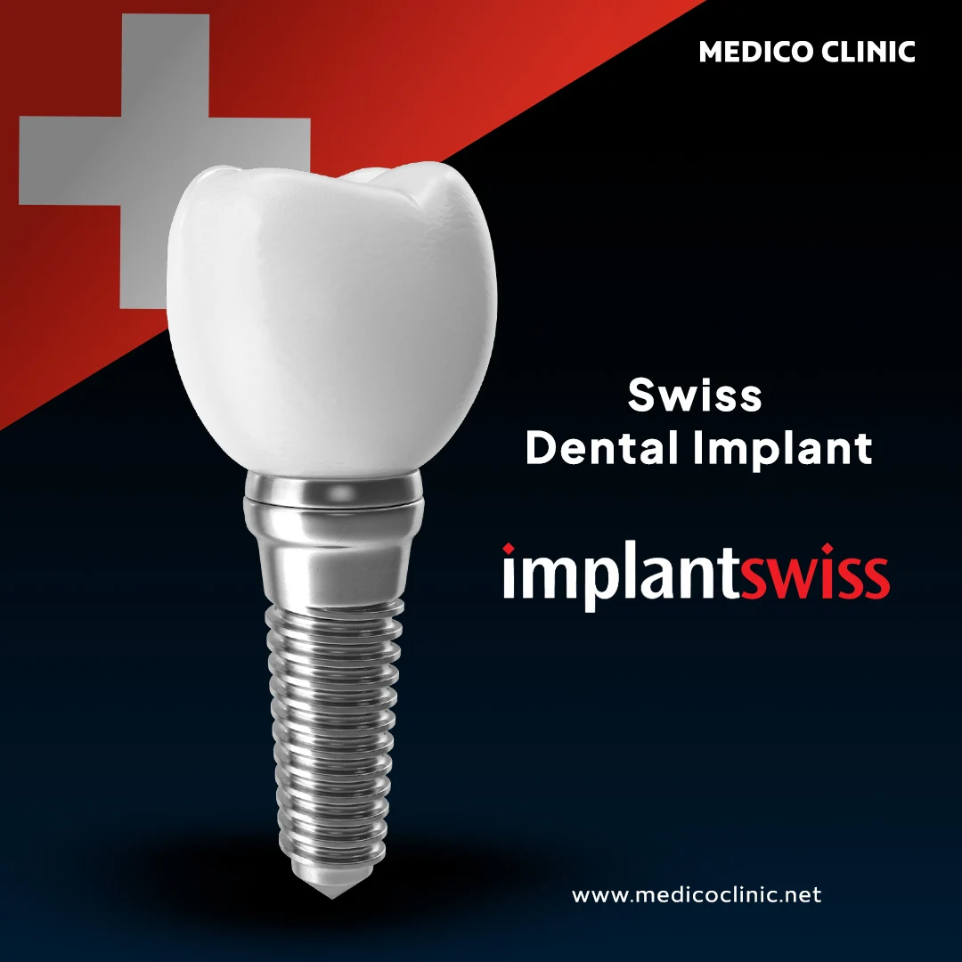 Implantswiss dental implant system
