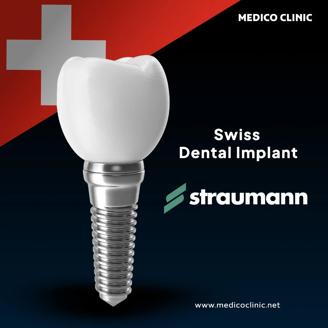 Dental Implants
